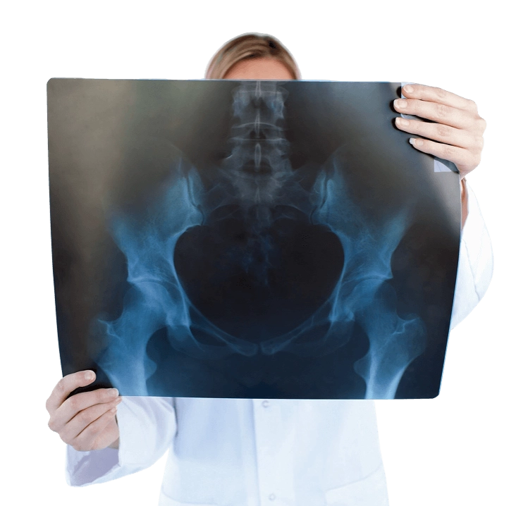 женщина врач с рентгеновским снимком